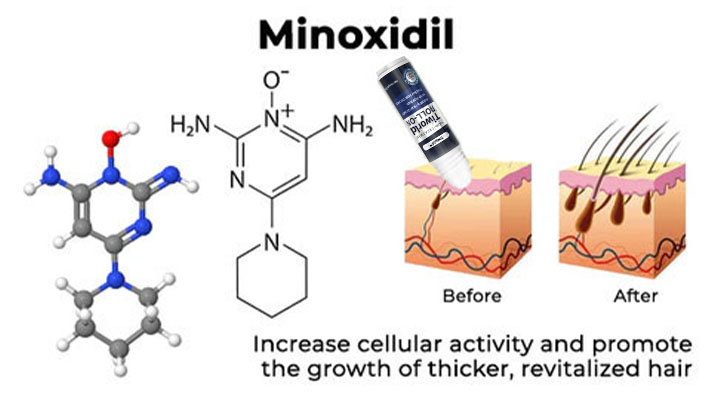 Last Day Promotion 70% OFF - š„Put an end to hair loss with LOVILDS⢠Foaming Serum!