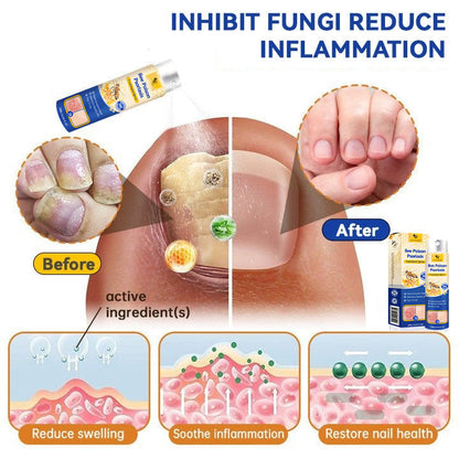 ✨【 official  Brand  Store】  Last Day Discount: 83% OFF 🌸 LOVILDS™ PsoriaHeal  psoriasis Spray pro