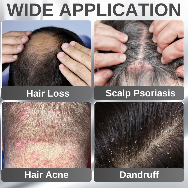 🔥Last Day Discount🔥 LOVILDS™ Anti-Shedding Hair Spray💁‍♀️🧔