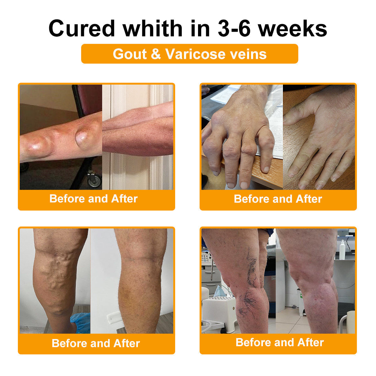 AQA™ Botulinum & Bee Essence Pain-Relief Bone Healing Cream