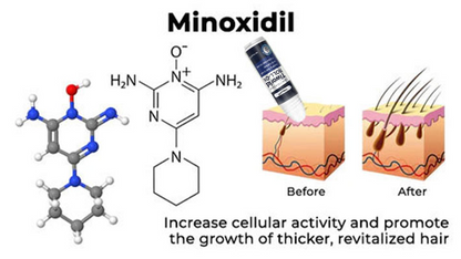 Last Day Promotion 70% OFF - 🔥Put an end to hair loss with LOVILDS™ Foaming Serum!