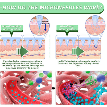 LOVILDS™ SMGT-GLP-1 Nano-Microneedle Patch (painless,  for diabetes,obesity and cardiovascular disease)