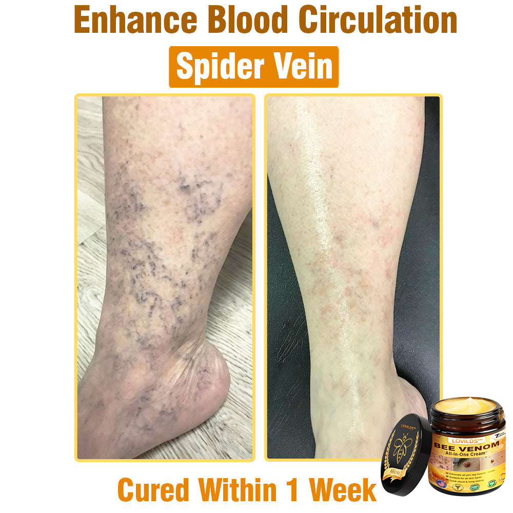 LOVILDS™ Bee Venom All-in-One Cream US Dermatologist Approved