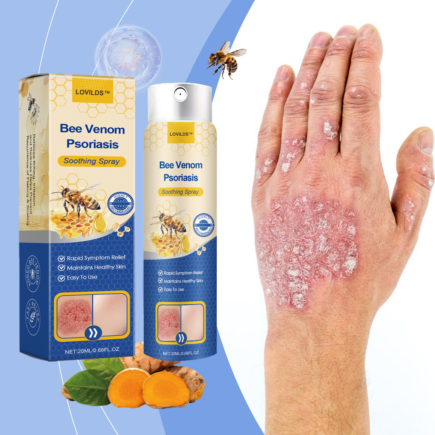 ✨【 official  Brand  Store】  Last Day Discount: 83% OFF 🌸 LOVILDS™ PsoriaHeal  psoriasis Spray pro
