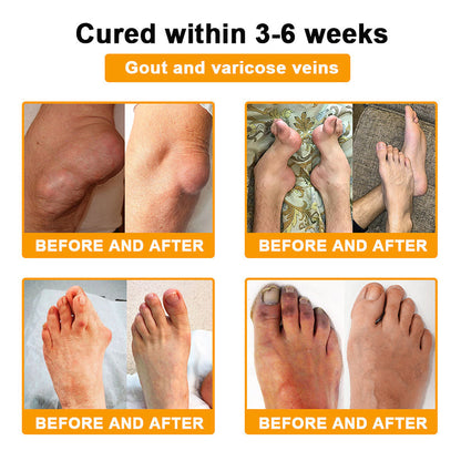 AQA™ Botulinum & Bee Essence Pain-Relief Bone Healing Cream