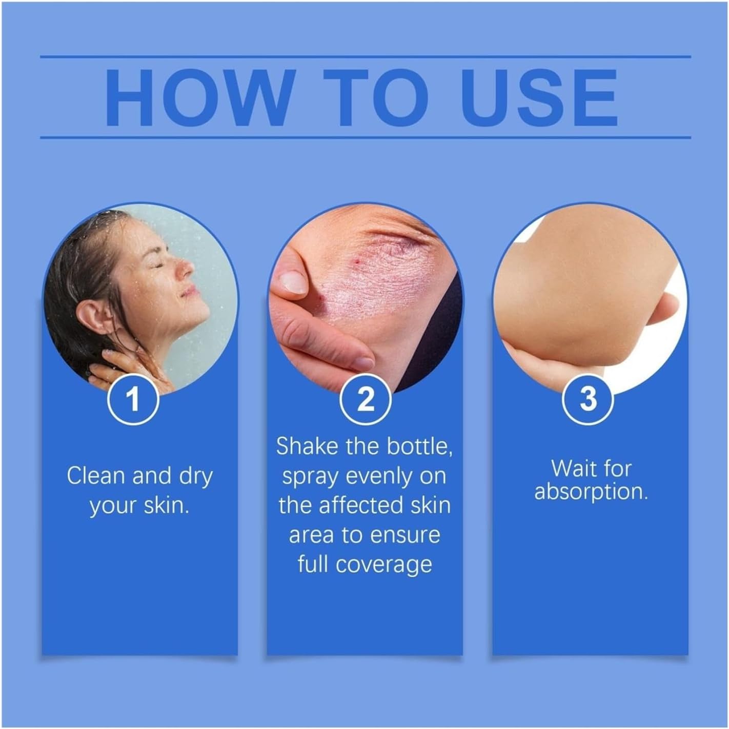 ✨【 official  Brand  Store】  Last Day Discount: 83% OFF 🌸 LOVILDS™ PsoriaHeal  psoriasis Spray pro