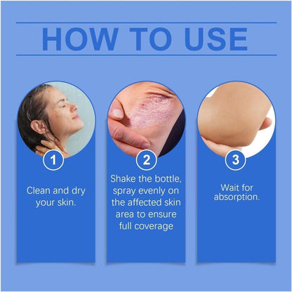 ✨【 official  Brand  Store】  Last Day Discount: 83% OFF 🌸 LOVILDS™ PsoriaHeal  psoriasis Spray pro