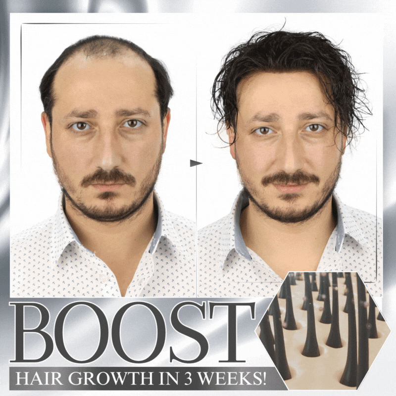 🔥Last Day Discount🔥 LOVILDS™ Anti-Shedding Hair Spray💁‍♀️🧔