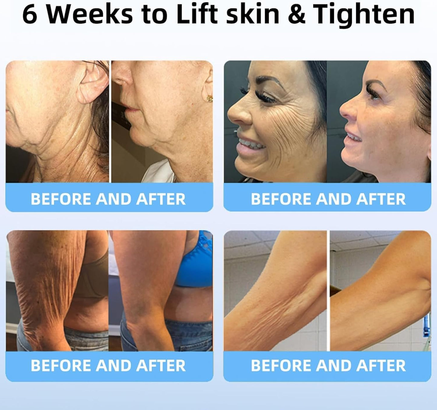 LOVILDS™ Bee Venom Lift Cream