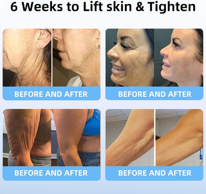 LOVILDS™ Bee Venom Lift Cream