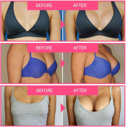 LOVILDS™ Bee Venom Lift Cream