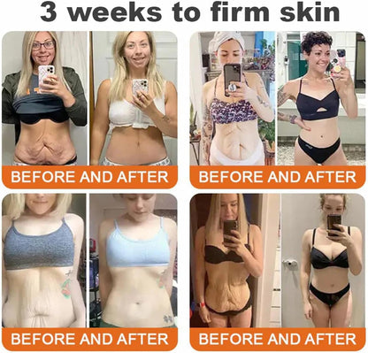 LOVILDS™ Bee Venom Lift Cream