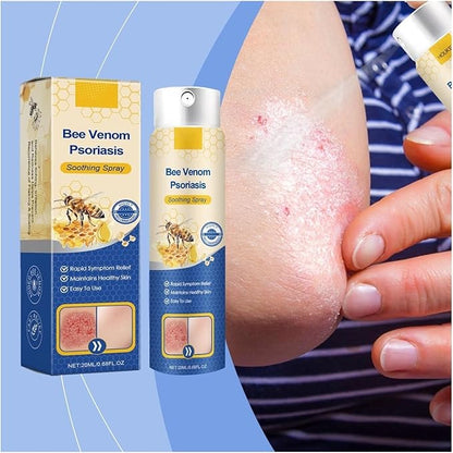 ✨【 official  Brand  Store】  Last Day Discount: 83% OFF 🌸 LOVILDS™ PsoriaHeal  psoriasis Spray pro