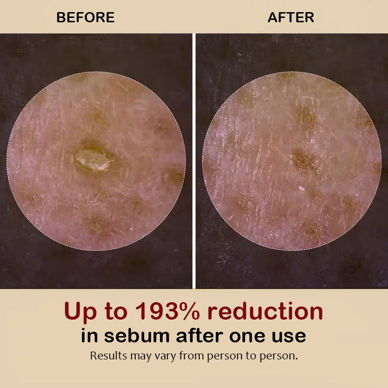 Exfoliating Rice Peel Duo – Instantly Removes Dead Skin for Smooth, Glowing Skin