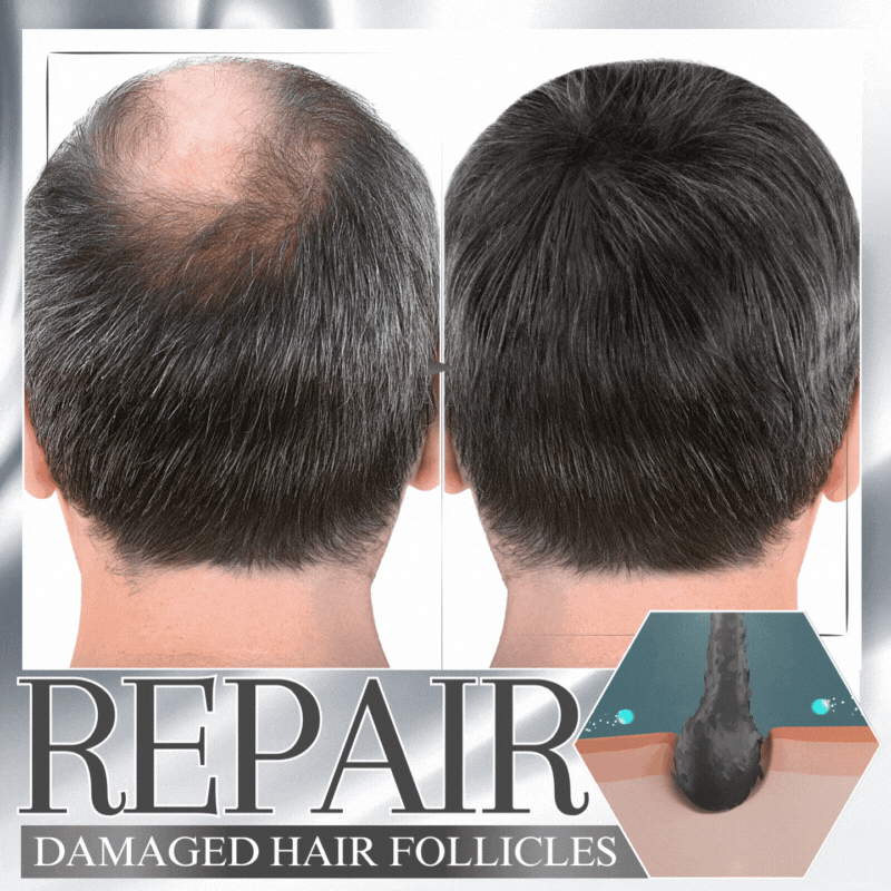 🔥Last Day Discount🔥 LOVILDS™ Anti-Shedding Hair Spray💁‍♀️🧔