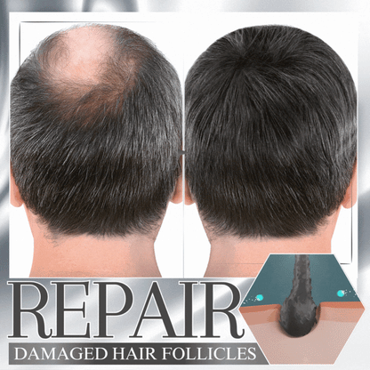 🔥Last Day Discount🔥 LOVILDS™ Anti-Shedding Hair Spray💁‍♀️🧔