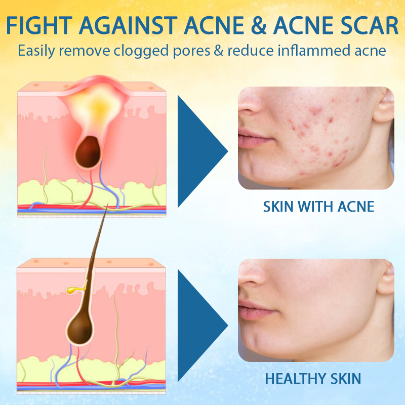 LOVILDS™ Psoriasis Care Mellifera Venom Skin Healing Spray🔥