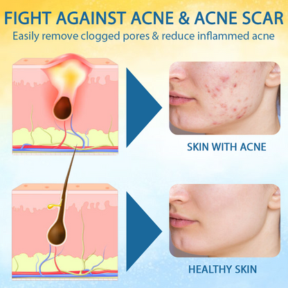 LOVILDS™ Psoriasis Care Mellifera Venom Skin Healing Spray🔥