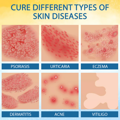 LOVILDS™ Psoriasis Care Mellifera Venom Skin Healing Spray🔥