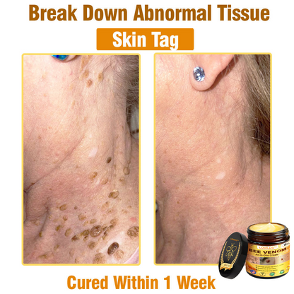 LOVILDS™ Bee Venom All-in-One Cream US Dermatologist Approved