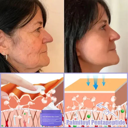 LOVILDS™ Bee Venom Lift Cream