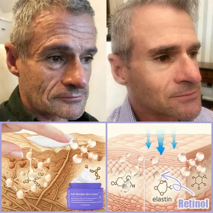 LOVILDS™ Bee Venom Lift Cream