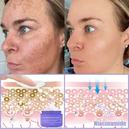 LOVILDS™ Bee Venom Lift Cream