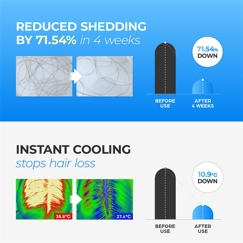 ✨【 official  Brand  Store】  Last Day Discount: 83% OFF 🌸 LOVILDS™ Scalpy Hair Growth Serum