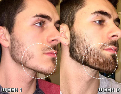 Last Day Promotion 70% OFF - 🔥Put an end to hair loss with LOVILDS™ Foaming Serum!