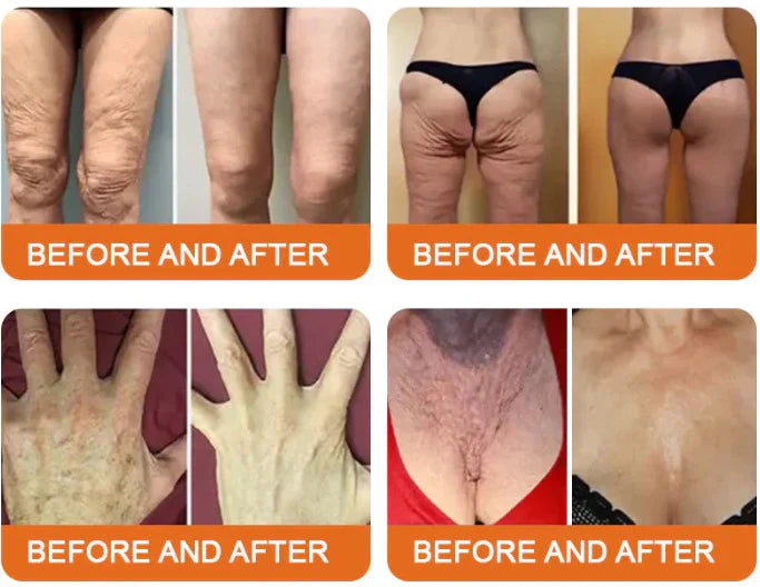 LOVILDS™ Bee Venom Lift Cream