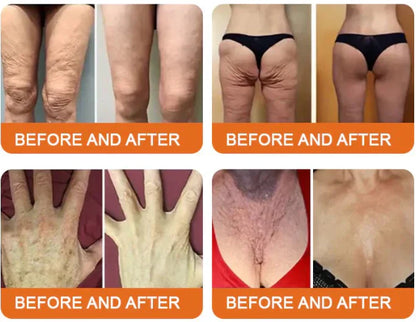 LOVILDS™ Bee Venom Lift Cream