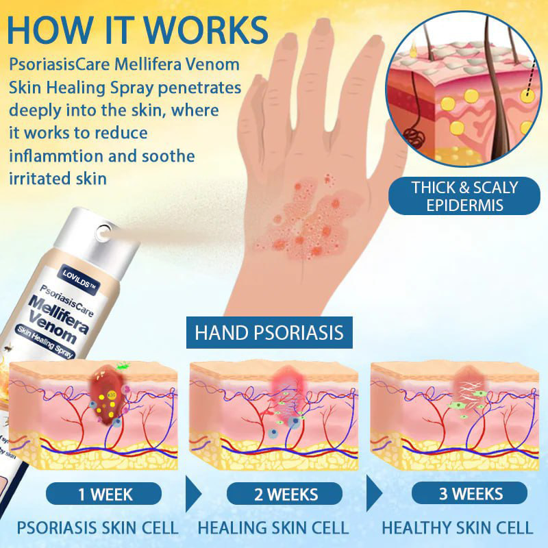 LOVILDS™ Psoriasis Care Mellifera Venom Skin Healing Spray🔥